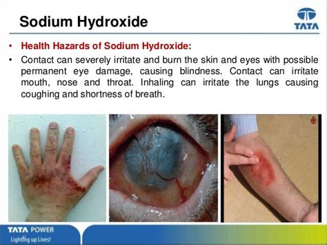 sodium hydroxide on skin.